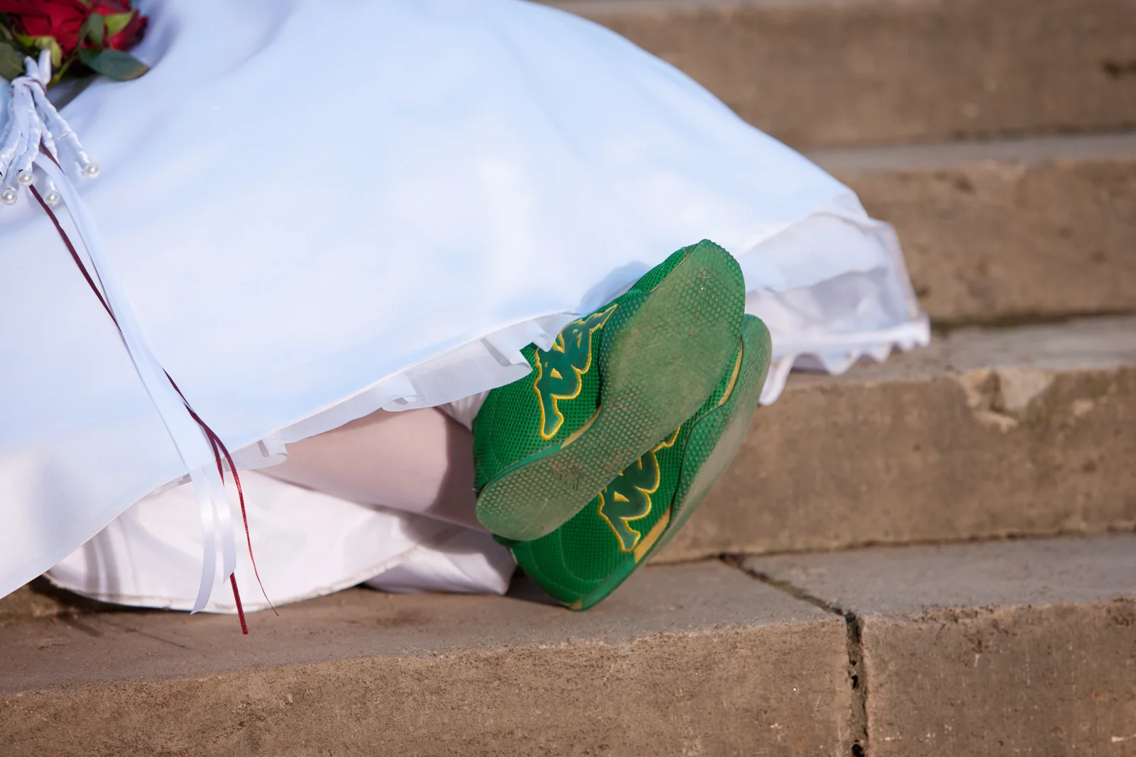 Brautschuh und grüner Gips nebeneinander – Hochzeitsreportage von Vanessa und Sebastian